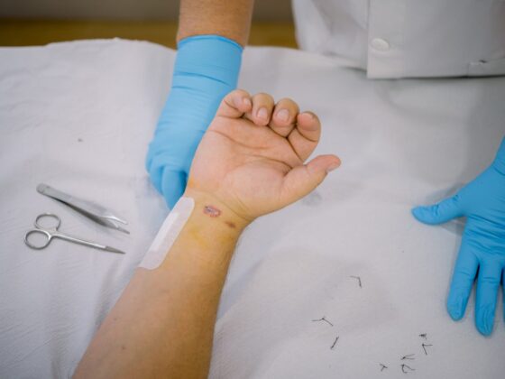 Crop patient and surgeon after stitches removal